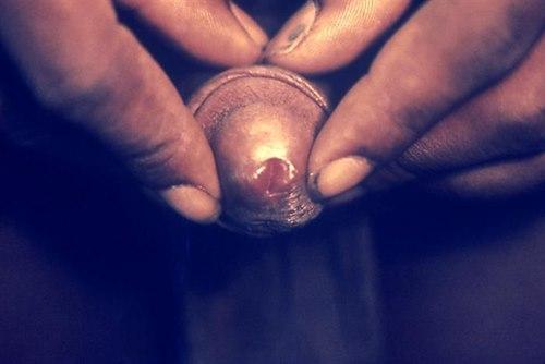 3277-2-penis.jpg 3277-2-penis.jpg