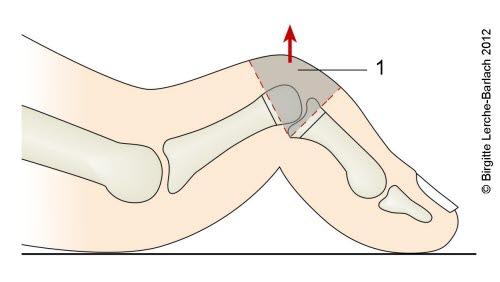 9092-2-id599-hammerta.jpg 9092-2-id599-hammerta.jpg