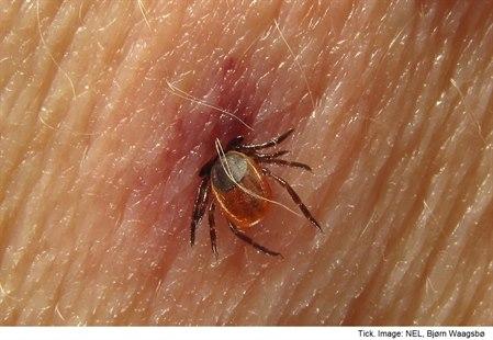 Tick bite